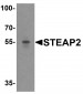 STEAP2 Antibody