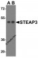 STEAP3 Antibody