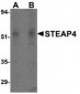 STEAP4 Antibody