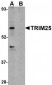 TRIM25 Antibody