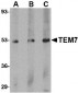 TEM7 Antibody