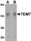 TEM7 Antibody