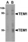 TEM1 Antibody