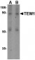 TEM1 Antibody