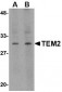 TEM2 Antibody