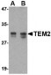TEM2 Antibody