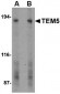 TEM5 Antibody
