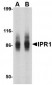 IPR1 Antibody