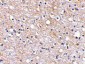 Plxdc2 Antibody