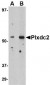 Plxdc2 Antibody