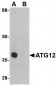 ATG12 Antibody