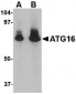 ATG16 Antibody