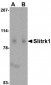 Slitrk1 Antibody