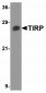 Slitrk1 Antibody