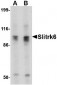 Slitrk6 Antibody