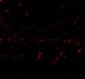 LGI1 Antibody