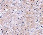 LGI1 Antibody