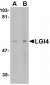 LGI4 Antibody