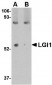 LGI1 Antibody