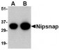 NIPSNAP Antibody