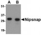 NIPSNAP Antibody