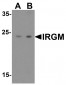 IRGM Antibody
