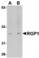 RGP1 Antibody
