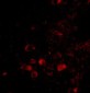 ELOVL6 Antibody
