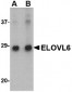 ELOVL6 Antibody