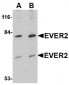 EVER2 Antibody