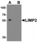 LIMP2 Antibody