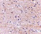 SATB2 Antibody