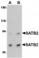 SATB2 Antibody