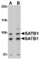 SATB1 Antibody