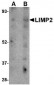 LIMP2 Antibody