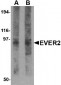 EVER2 Antibody