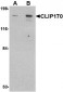 CLIP170 Antibody