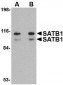 SATB1 Antibody