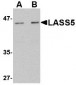 LASS5 Antibody