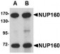 NUP160 Antibody