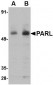 PARL Antibody