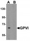 GPVI Antibody