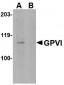 GPVI Antibody