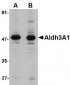 Aldh3A1 Antibody