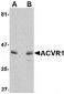 ACVR1 Antibody