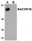 ACVR1B Antibody