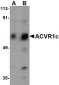 ACVR1C Antibody