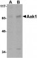 Aak1 Antibody
