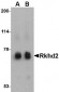 Rkhd2 Antibody
