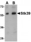 Stk39 Antibody